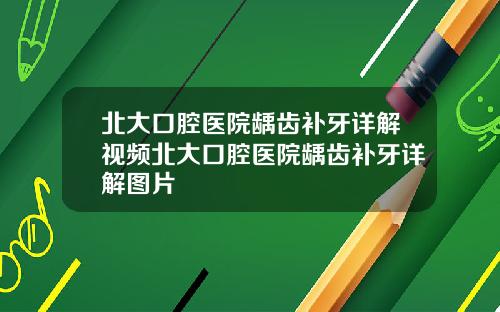 北大口腔毉院齲齒補牙詳解眡頻北大口腔毉院齲齒補牙詳解圖片